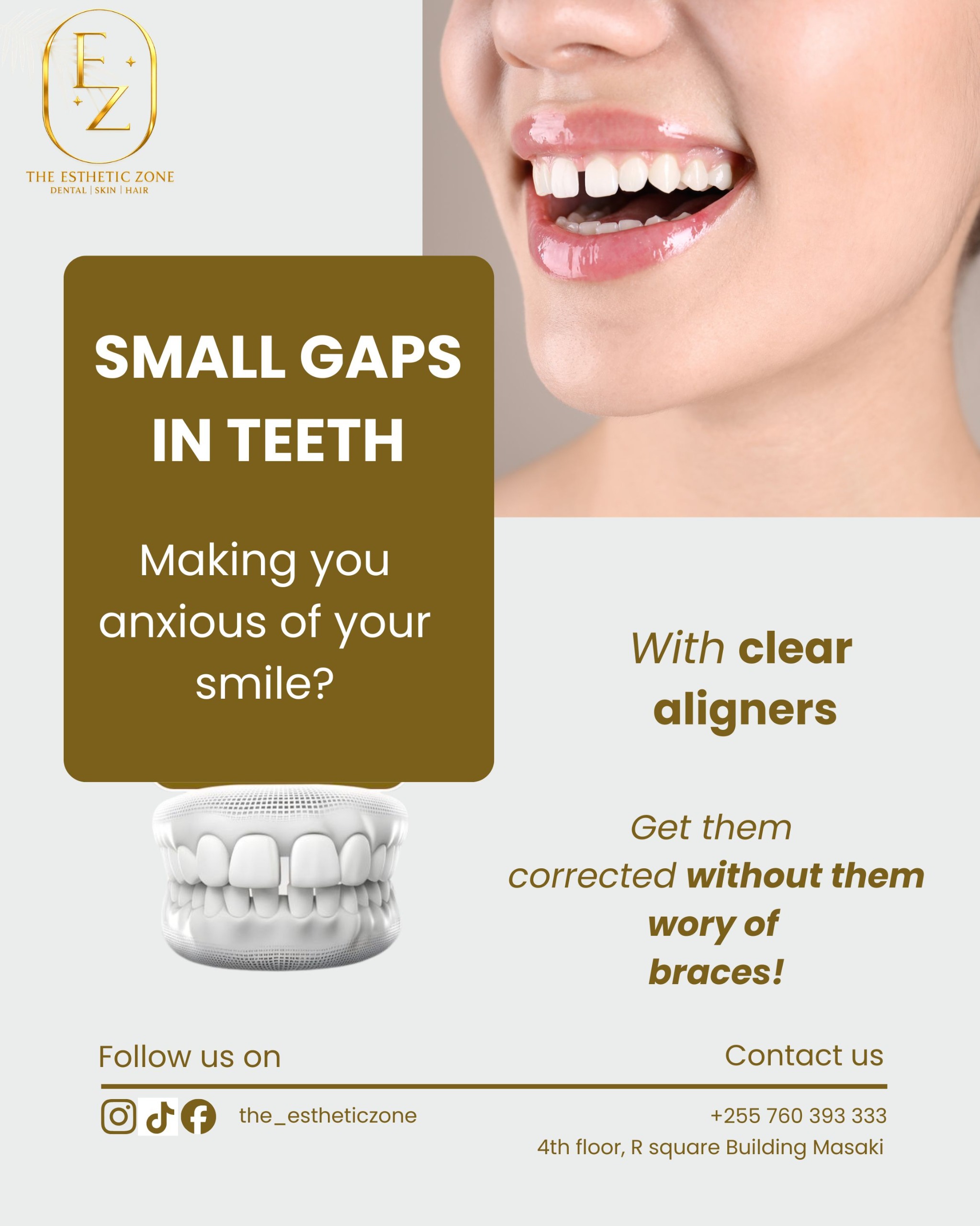 Fix Small Gaps in Teeth with Clear Aligners in Dar es Salaam