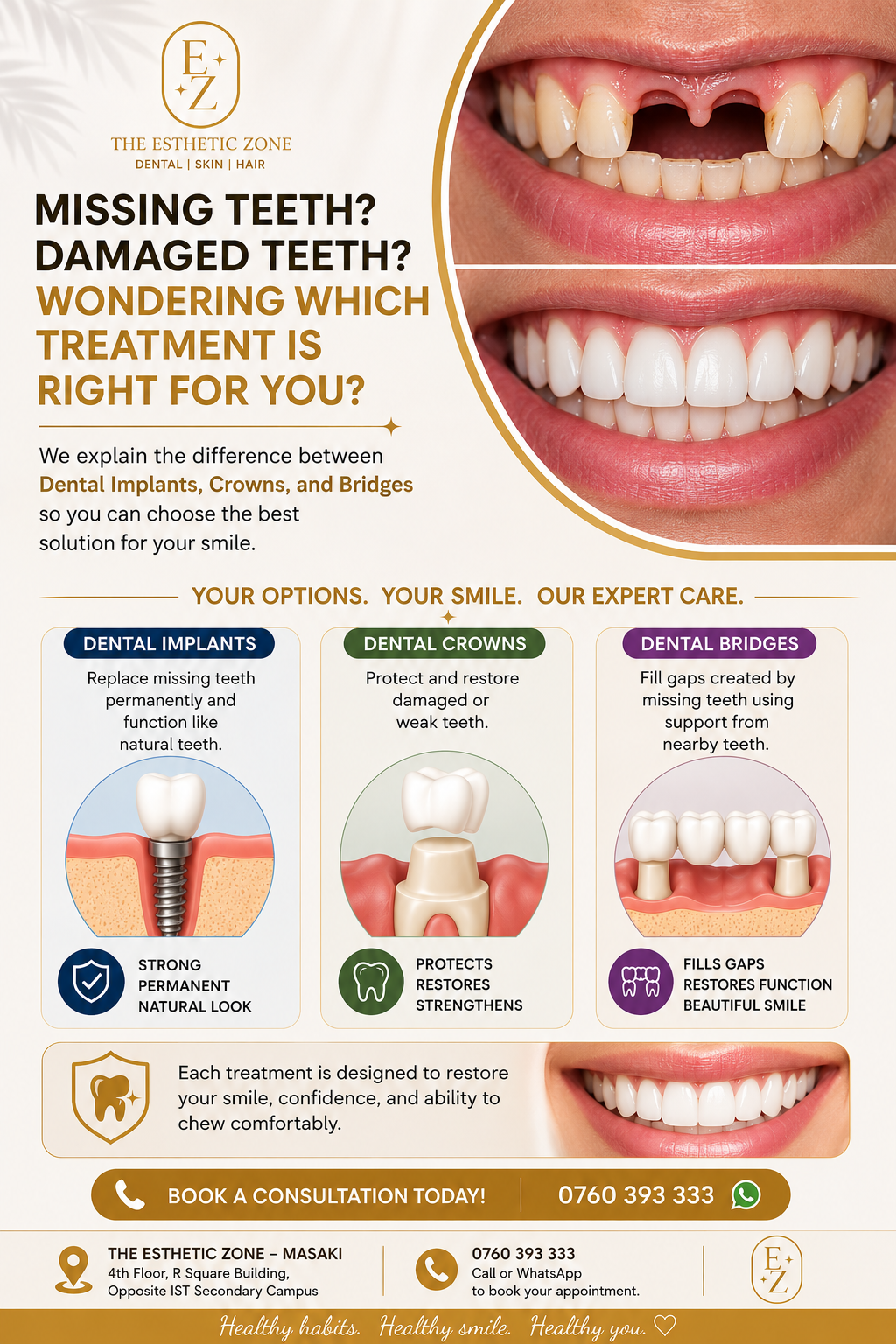 Dental Implants vs Crowns vs Bridges – Which Treatment Is Right For You?